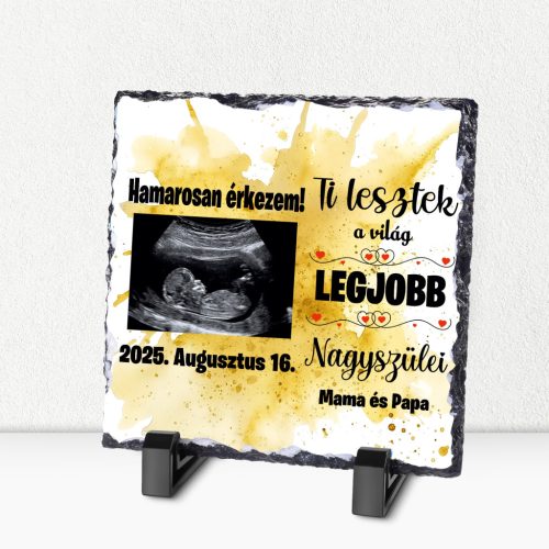 Ultrahangos kőlap nagyszülőknek – „Ti lesztek a világ legjobb nagyszülei!”